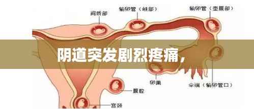 阴道突发剧烈疼痛,